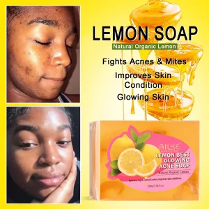 Dark Spots and Acne Remover Soap